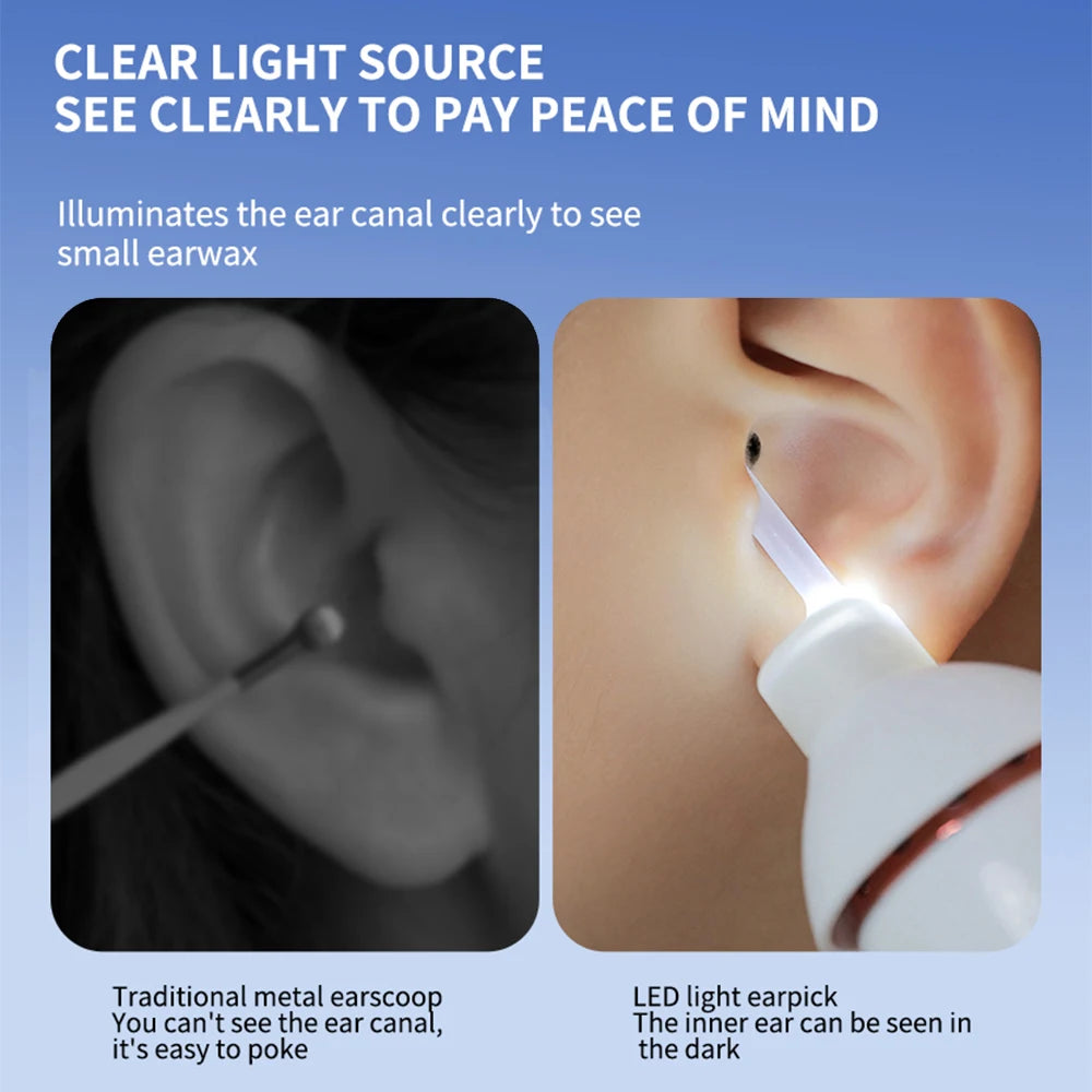 Agdoad Electric Suction Ear Cleaner With Light And Vacuum