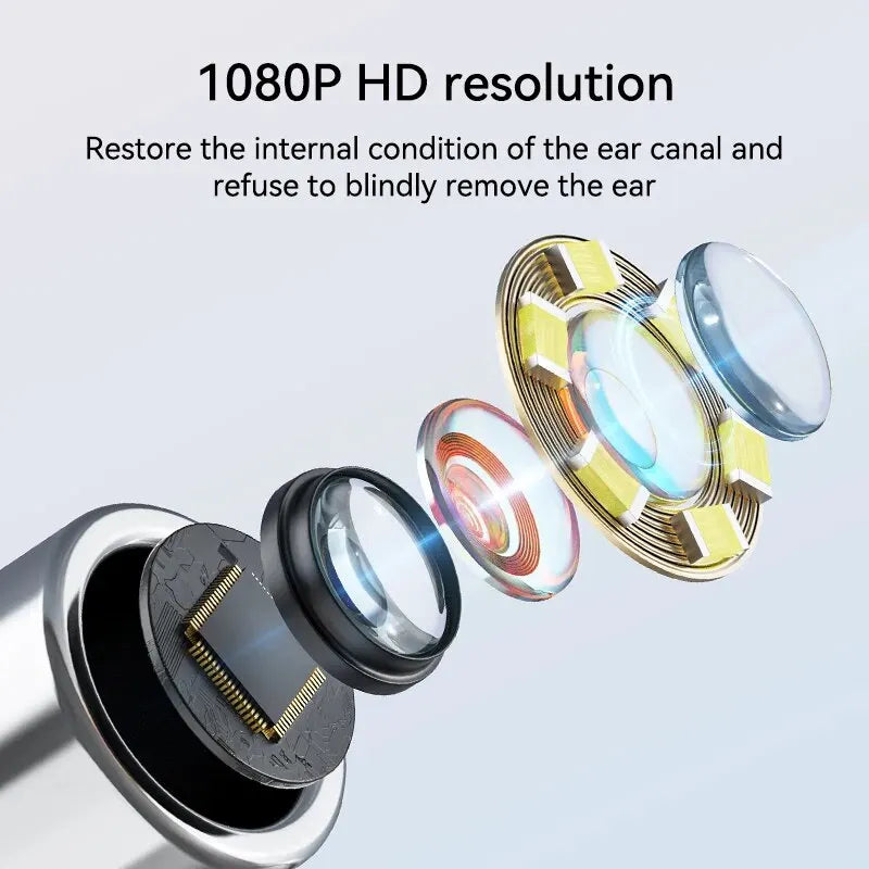 Sunnyside Medical Supplies Otoscope Ear Camera IPS Screen