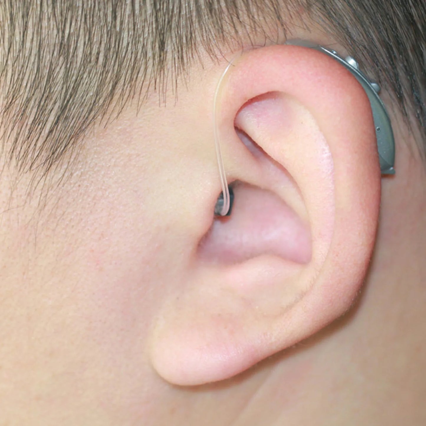 CHOSGO Hearing Aids With App Control Noise Cancellation