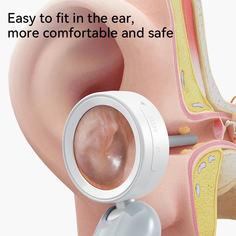 INSKAM Otoscope Ear Camera 1080P With LED Photo Video