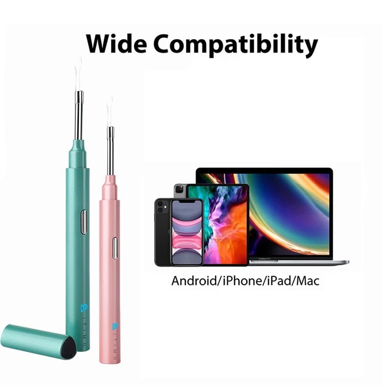 Sunnyside Medical Supplies Ear Scope Otoscope 1080P Camera