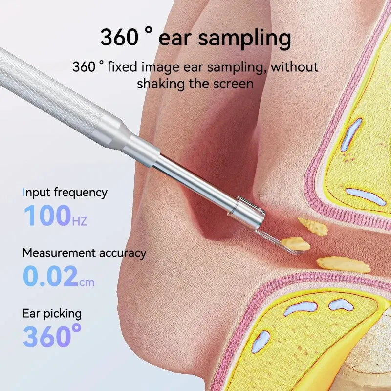Sunnyside Medical Supplies Otoscope Ear Camera IPS Screen