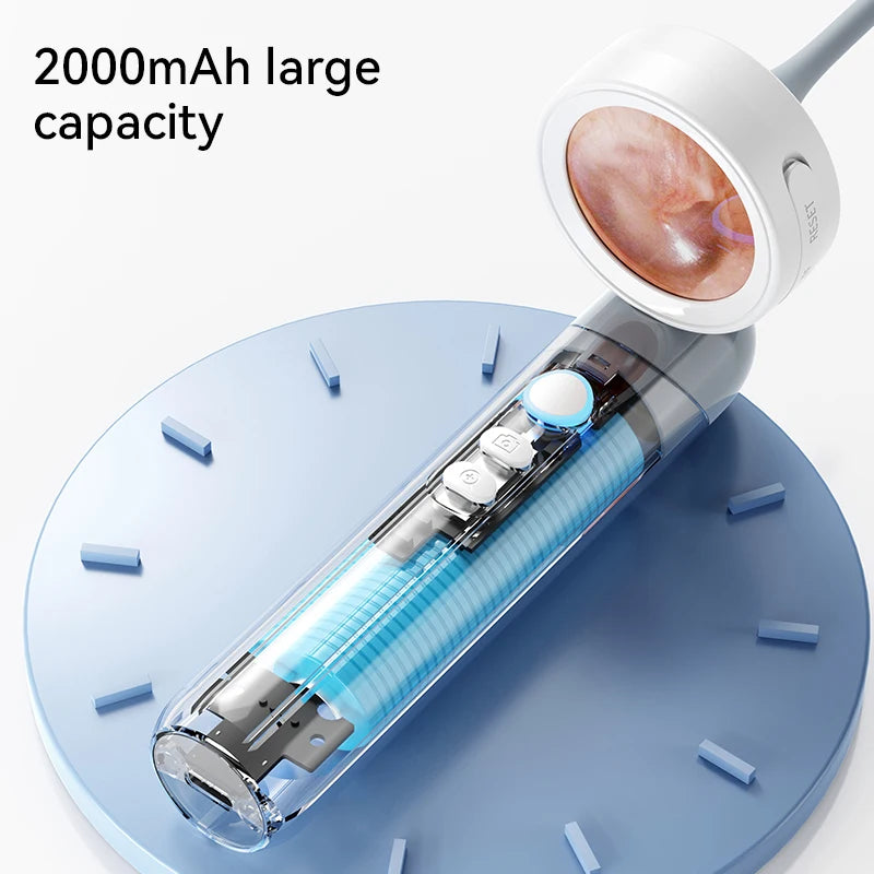 INSKAM Otoscope Ear Camera 1080P With LED Photo Video