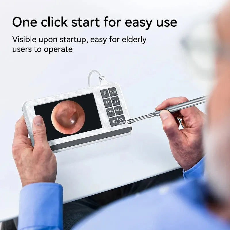 Sunnyside Medical Supplies Otoscope Ear Camera IPS Screen