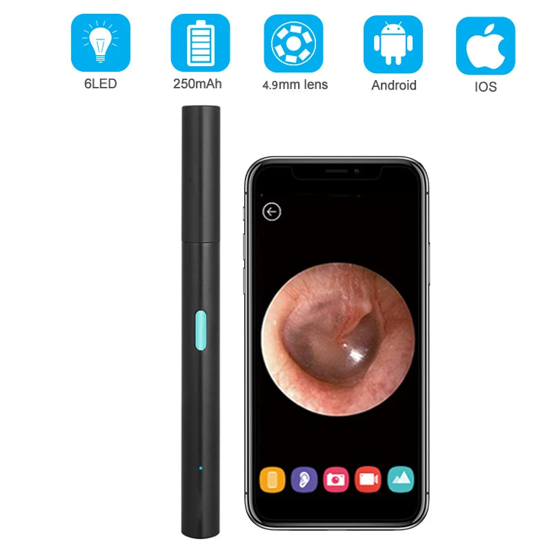 Wireless Smart Visual Ear Cleaner Otoscope Wifi Ear Wax Removal Tool with Camera Ear Endoscope 1080P Kit for IOS Android 4.9mm
