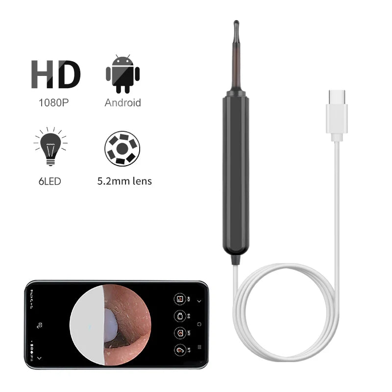 Sunnyside Medical Supplies Ear Wax Endoscope Otoscope Kit