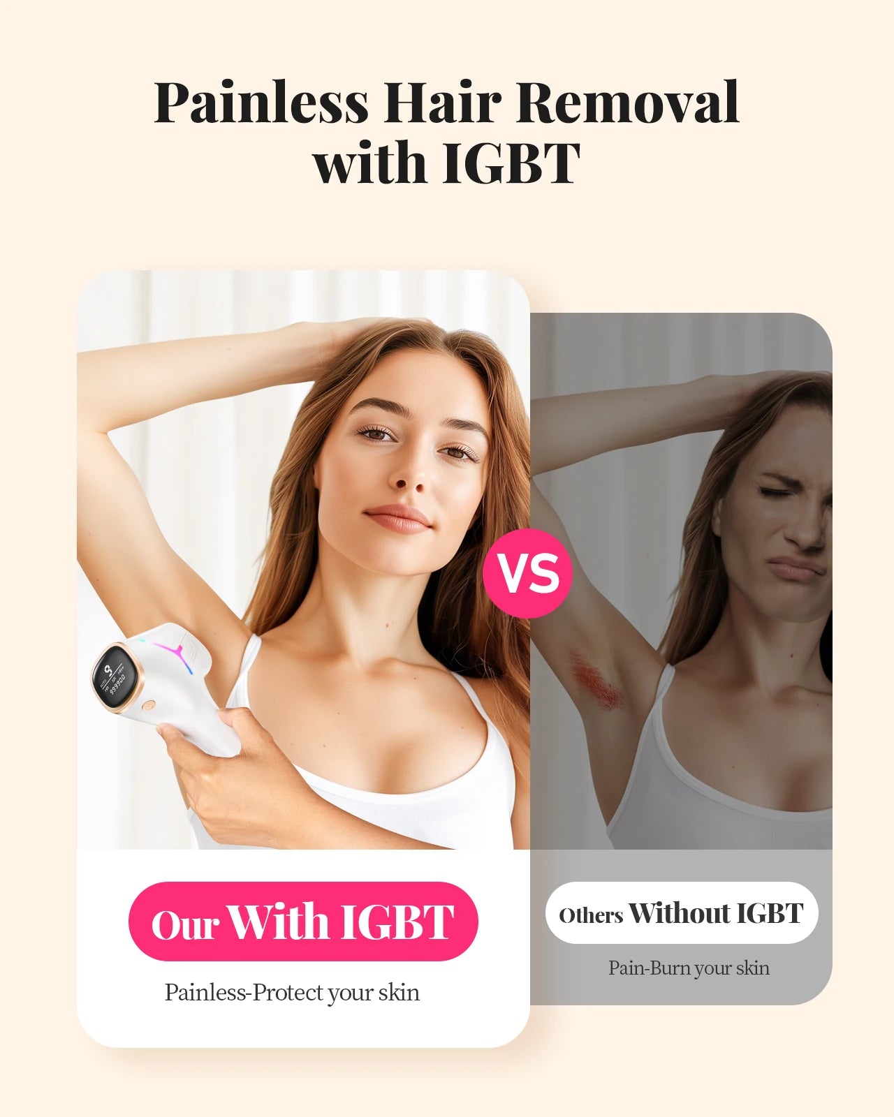 Totmizby IPL Laser Hair Removal Device For Body And Face