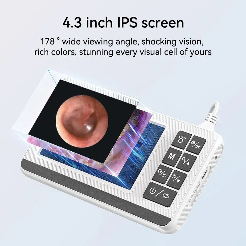 Sunnyside Medical Supplies Digital Otoscope Ear Camera IPS