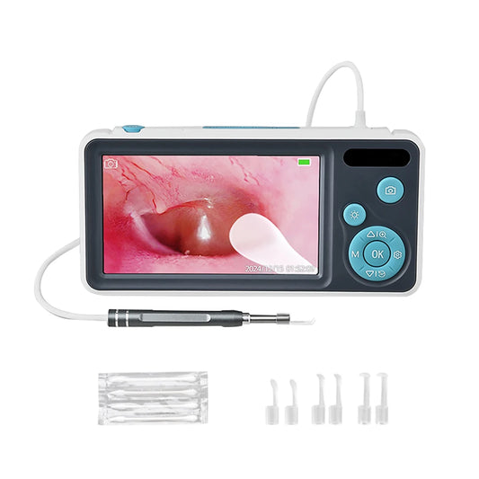 Sunnyside Medical Supplies Digital Otoscope Ear Camera IPS